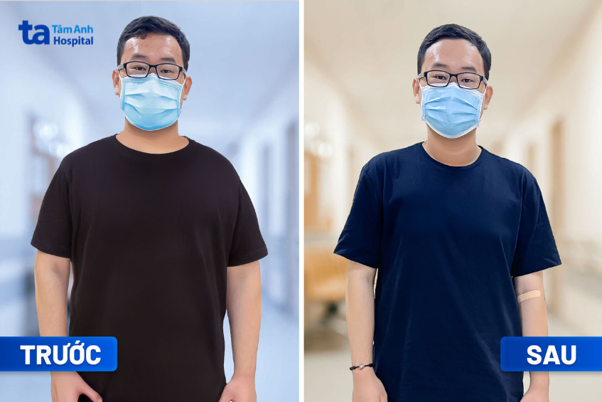 Lê Đức Anh trước và sau giảm cân tại Tâm Anh