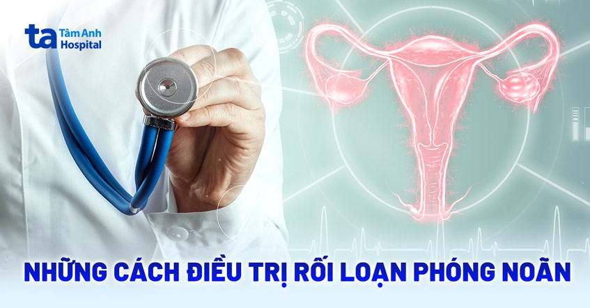 3 cách điều trị rối loạn phóng noãn theo từng mục tiêu cụ thể