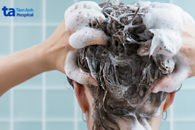 điều trị viêm da tiết bã bằng dầu gội đầu