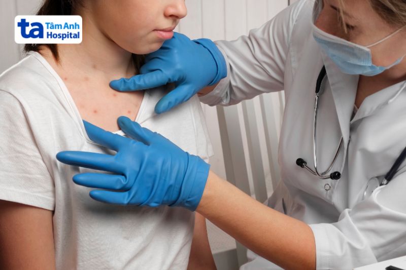 thăm khám bác sĩ nếu bị ngứa do sốt phát ban