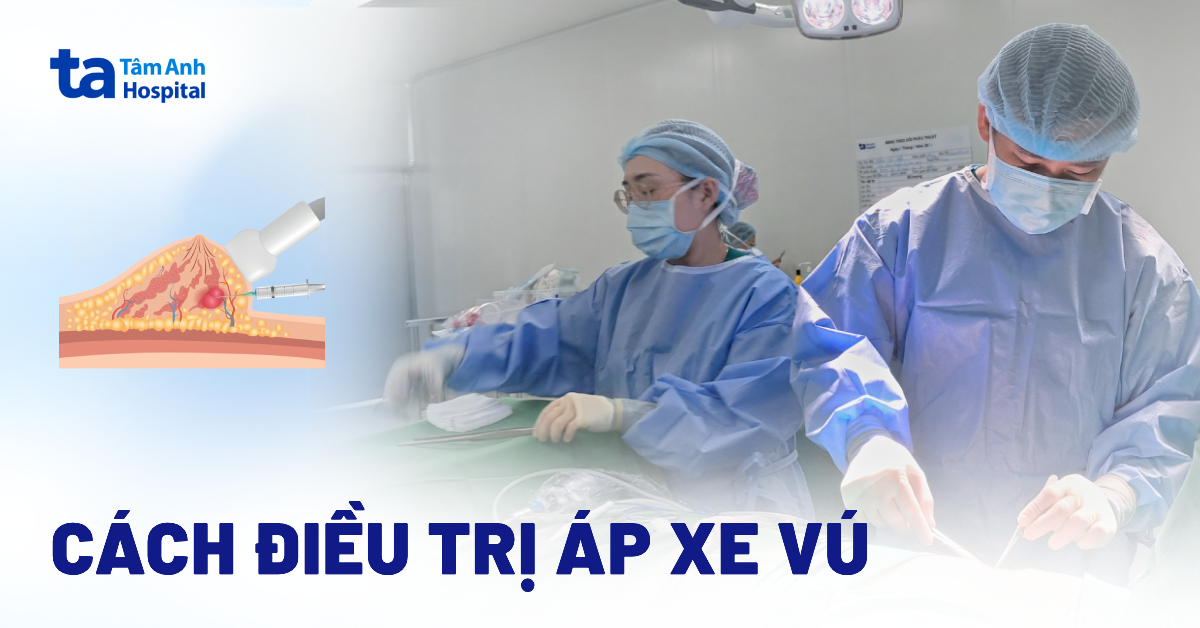 3 cách trị áp xe vú an toàn hiệu quả được bác sĩ tin dùng