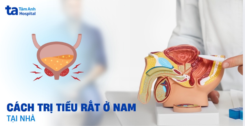 8 cách trị tiểu rắt ở nam tại nhà nhanh nhất an toàn dễ áp dụng