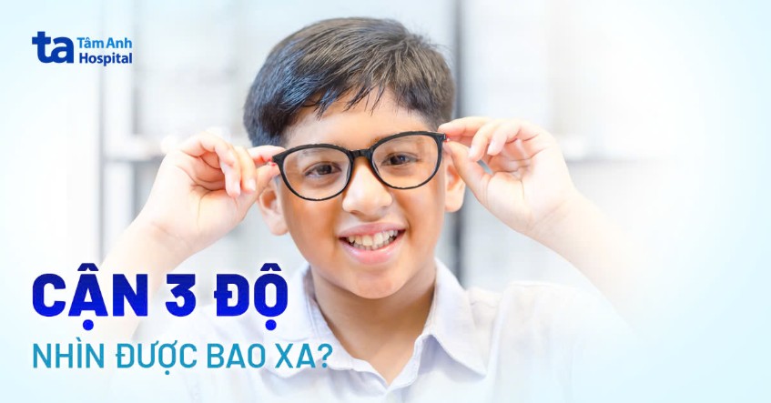 Mắt cận 3 độ nhìn được bao xa? Một số lưu ý giúp tầm nhìn ổn định