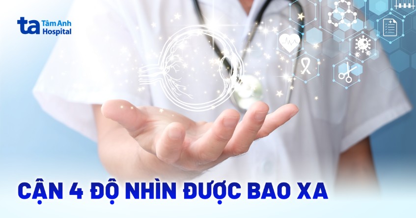 Mắt cận 4 độ nhìn được bao xa? Một số lưu ý giúp tầm nhìn ổn định