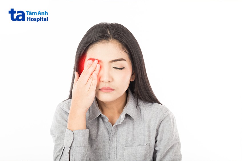 cần nắm rõ thông tin về xuất huyết dịch kính