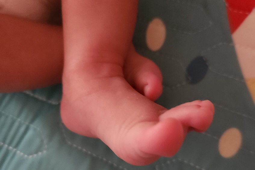 case bé bánh mì lp ivf hình chân
