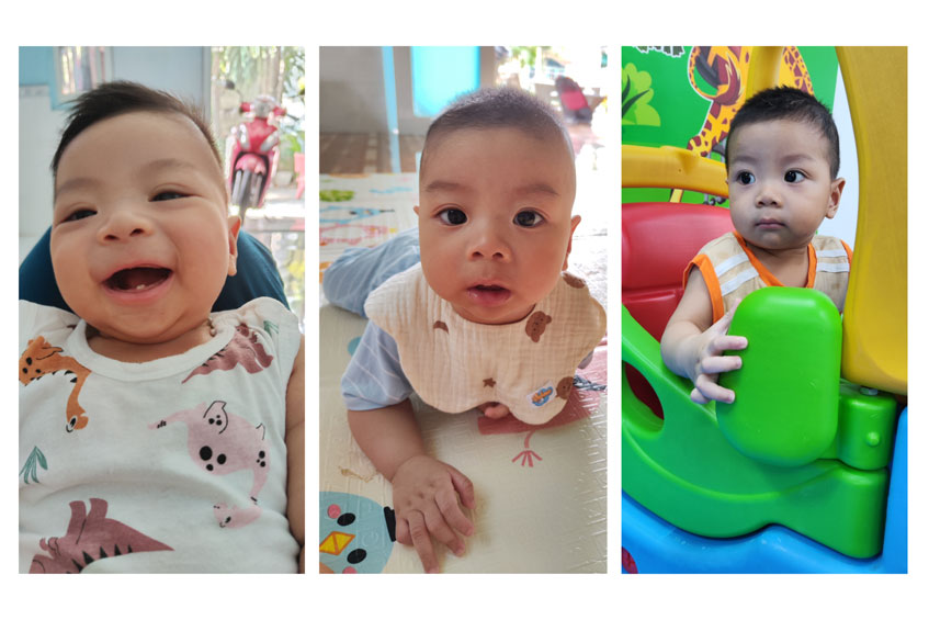 case huỳnh thị thảo lp ivf