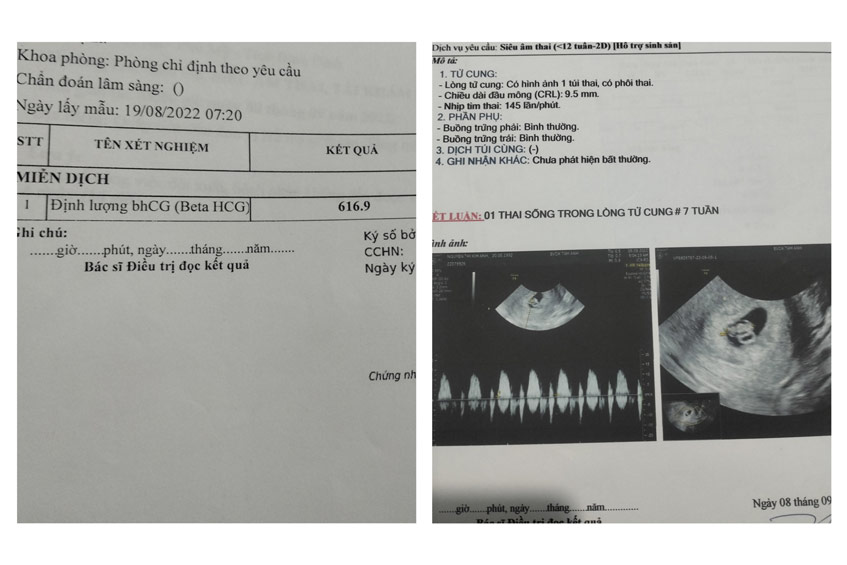 case Nguyễn Thị Kim Ánh LP IVFTA