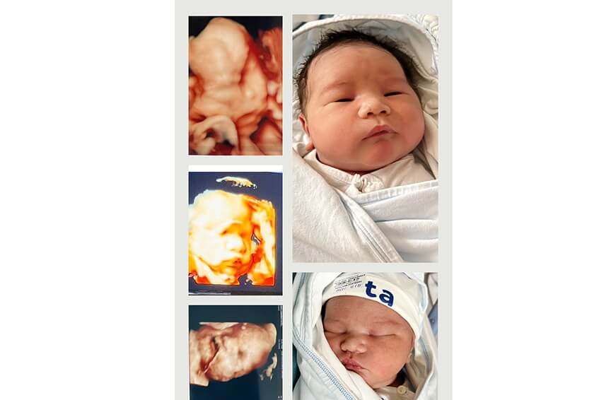 case rian zebedee jun lp ivf hinh 4
