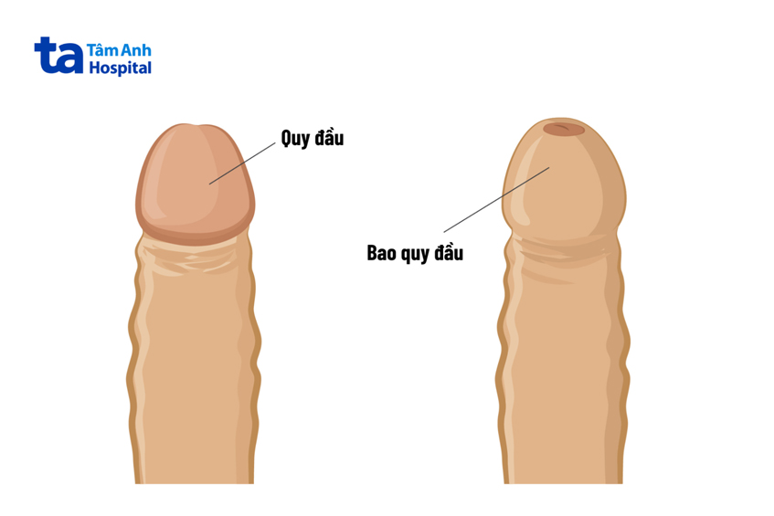 Thủ thuật cắt bao quy đầu có thể làm giảm tình trạng dương vật nhạy cảm quá mức khi quan hệ