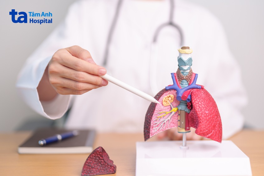 cắt thuỳ phổi có thể gây nên các biến chứng nguy hiểm