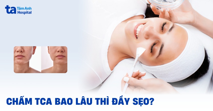 Chấm TCA bao lâu thì đầy sẹo? Yếu tố nào ảnh hưởng thời gian?