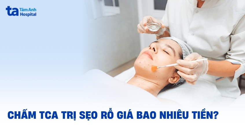 chấm tca trị sẹo rỗ giá bao nhiêu