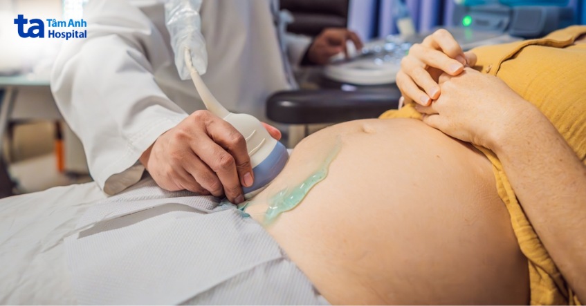 chẩn đoán thận ứ nước ở phụ nữ mang thai