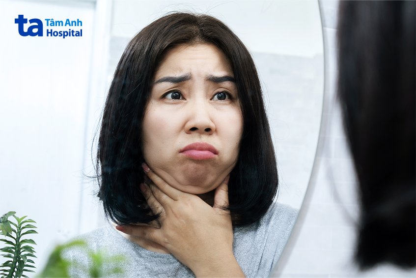 chế độ ăn dễ gây mỡ mặt