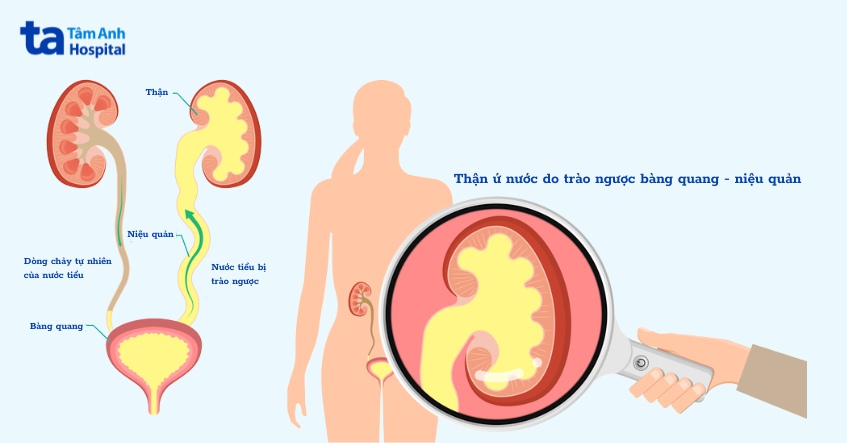 chỉ định và chống chỉ định
