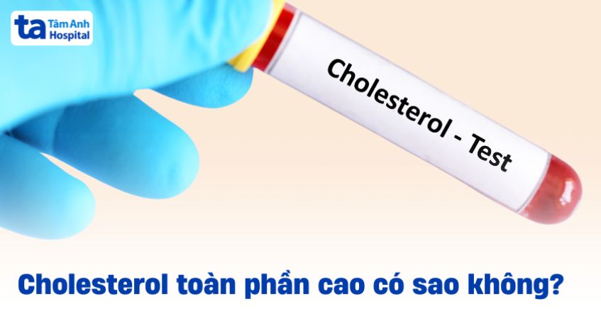 Định lượng cholesterol toàn phần cao có sao không? Khi nào nguy hiểm?