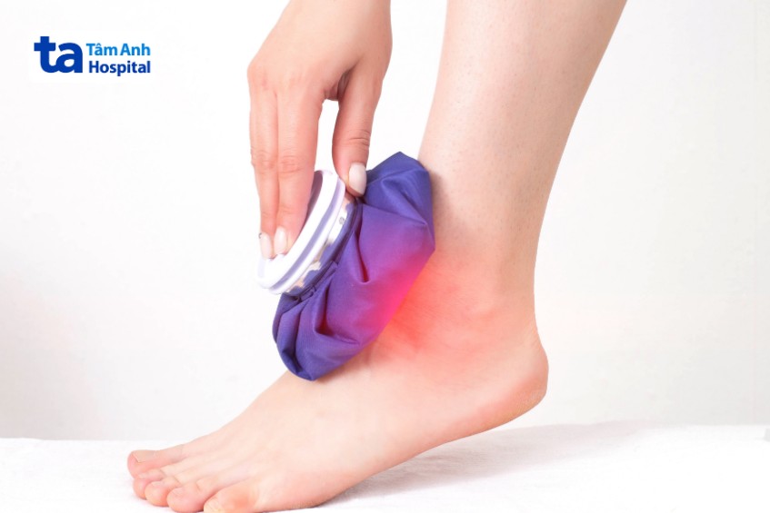 chườm lạnh góp phần giảm đau và sưng