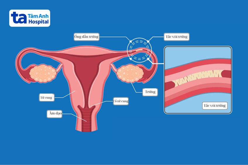 chup-hsg-phat-hien-bat-thuong