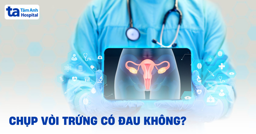 Chụp vòi trứng có đau không? Có rủi ro nào không? Bác sĩ trả lời
