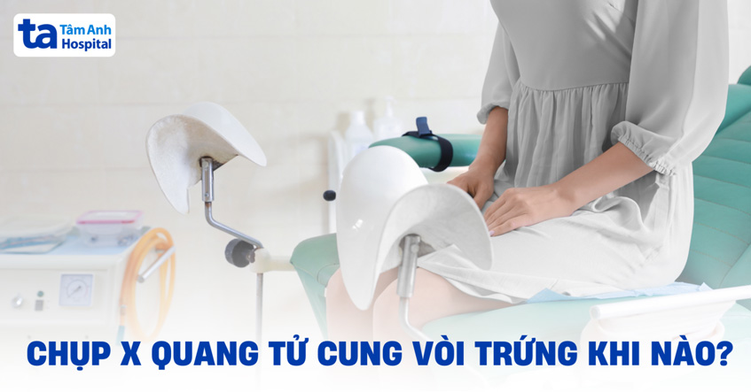Chụp X quang tử cung vòi trứng khi nào là tốt nhất? Bác sĩ trả lời