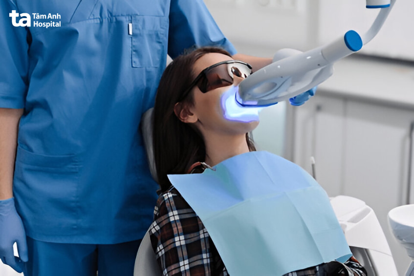 có nên tẩy trắng răng ở nha khoa