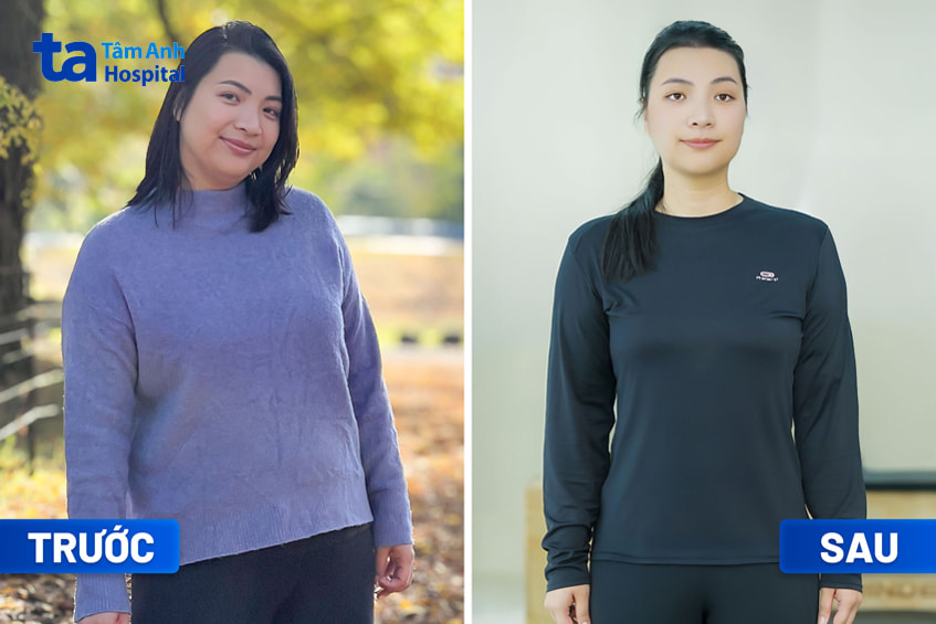 Kết quả giảm cân của Chị Trần Phan Cẩm Hà