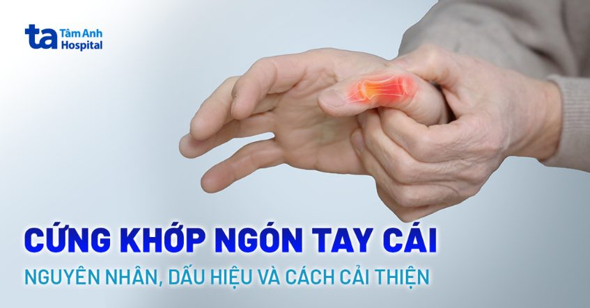 Cứng khớp ngón tay cái: Nguyên nhân, dấu hiệu và cách cải thiện