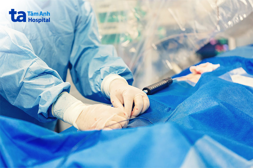 Đặt stent mạch vành được thực hiện khi có chỉ định của bác sĩ