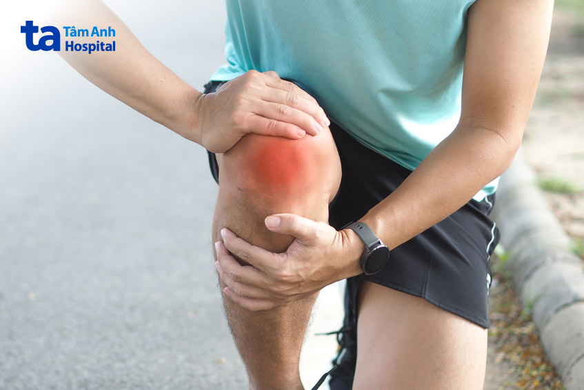 Đau đầu gối khi vận động kèm sưng tấy
