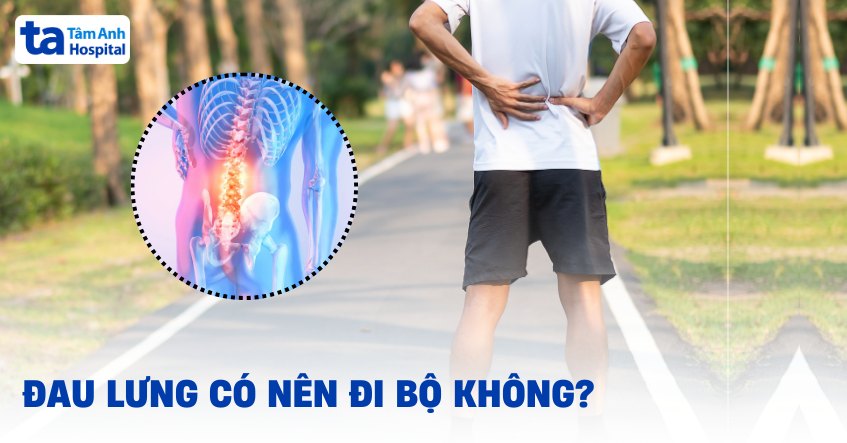 Người bị đau lưng có nên đi bộ không? Cách đi và một số lưu ý