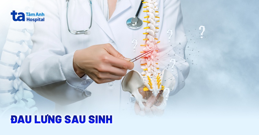 Đau lưng sau sinh: Nguyên nhân, triệu chứng và cách khắc phục