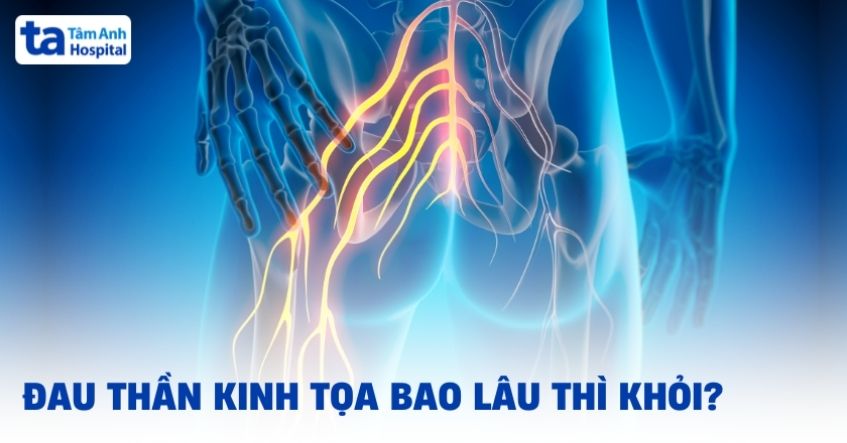 Đau thần kinh tọa bao lâu thì khỏi? Bệnh có tự hết không?