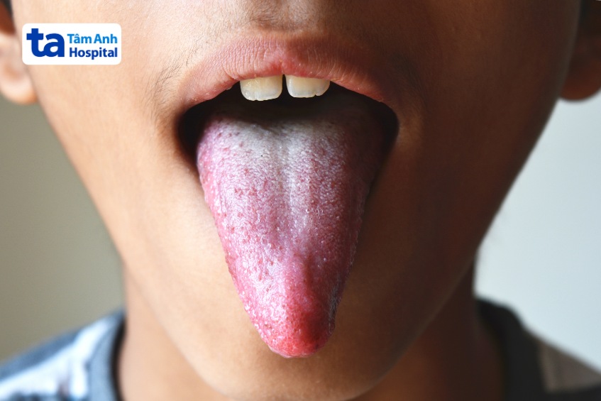 dây thần kinh sọ 12 điều khiển cơ lưỡi