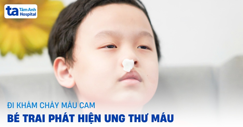 đi khám chảy máu cam, bé trai phát hiện ung thư máu