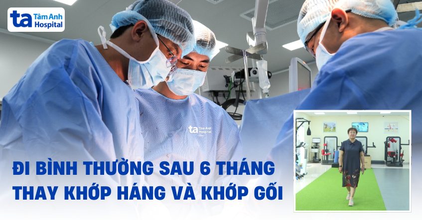 Đi lại bình thường sau 6 tháng thay cả khớp háng và khớp gối