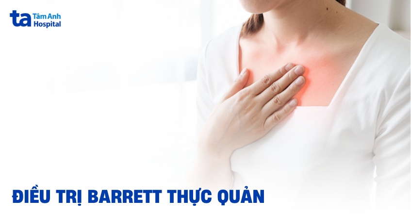 4 phương pháp điều trị Barrett thực quản hiệu quả, an toàn