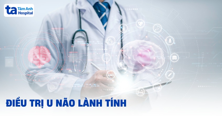 5 cách điều trị u não lành tính phổ biến, mang lại hiệu quả