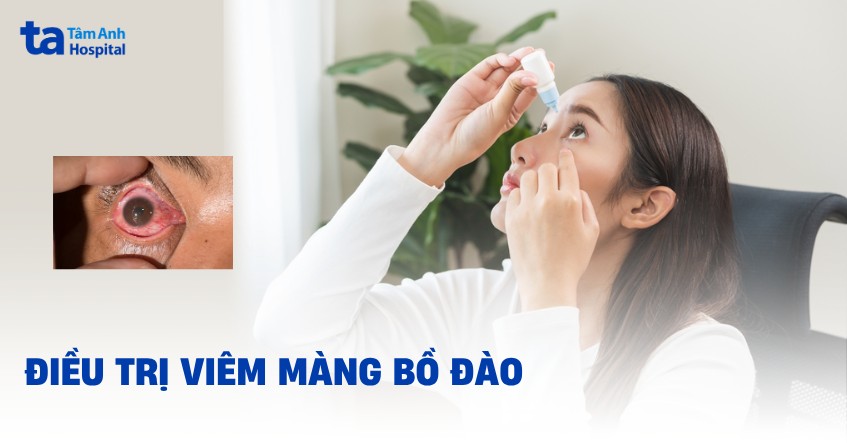 5 cách điều trị viêm màng bồ đào và hướng dẫn chăm sóc người bệnh