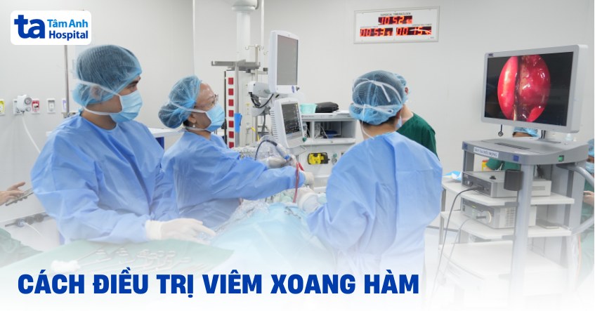 Cách điều trị viêm xoang hàm hiệu quả, an toàn và dự phòng
