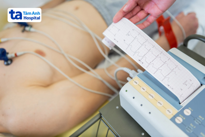 Đo điện tâm đồ giúp bác sĩ đánh giá và chẩn đoán bệnh suy tim