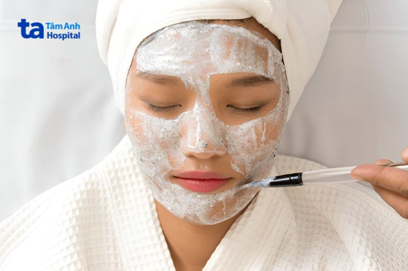 peel da điều trị đồi mồi