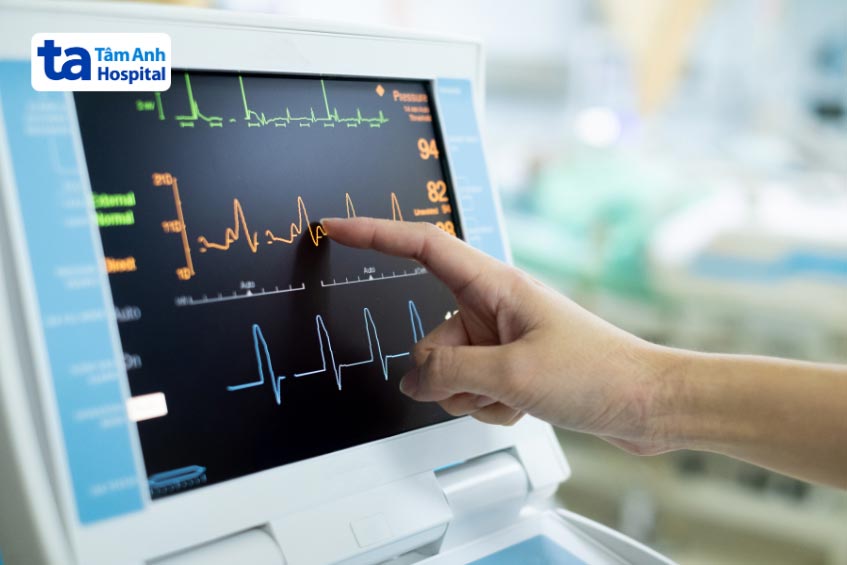 ecg trong chẩn đoán nhồi máu cơ tim