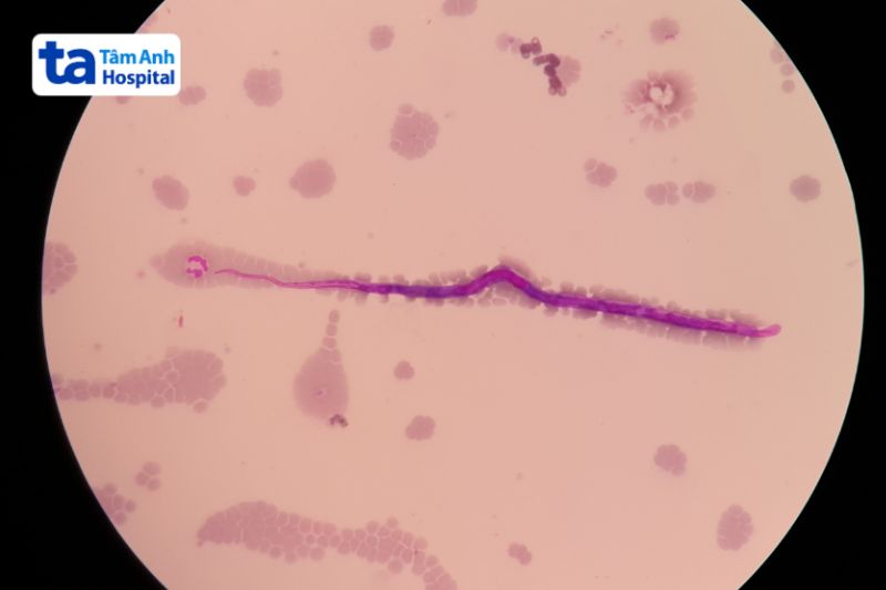 hình ảnh giun chỉ Brugia dưới kính hiển vi