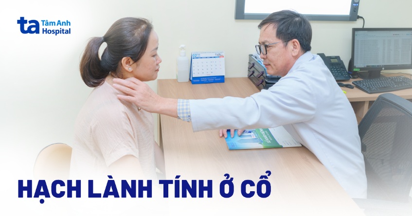 Hạch lành tính ở cổ: Dấu hiệu, nguyên nhân và cách điều trị