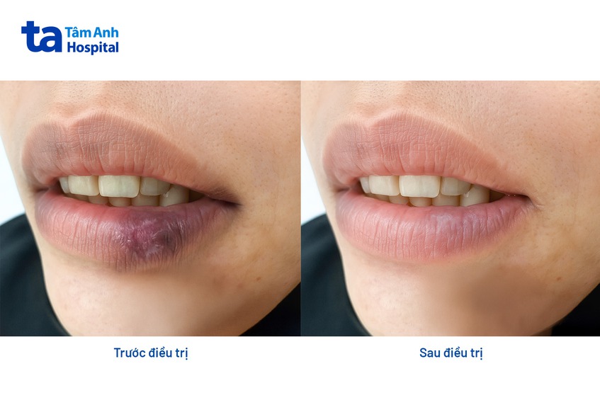 hình ảnh bệnh nhân