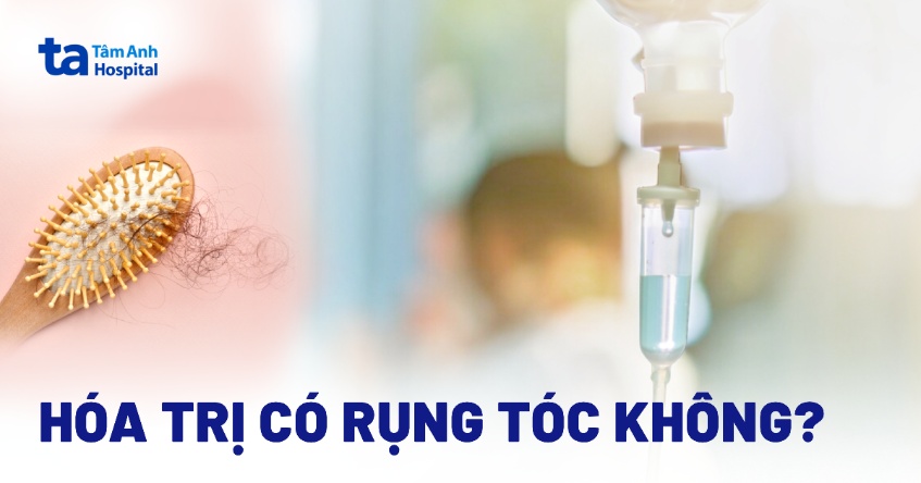 Hóa trị có rụng tóc không? Truyền hóa trị bao lâu thì rụng tóc?