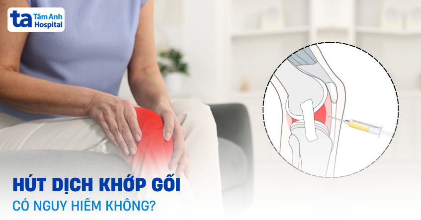 Hút dịch khớp gối có nguy hiểm không