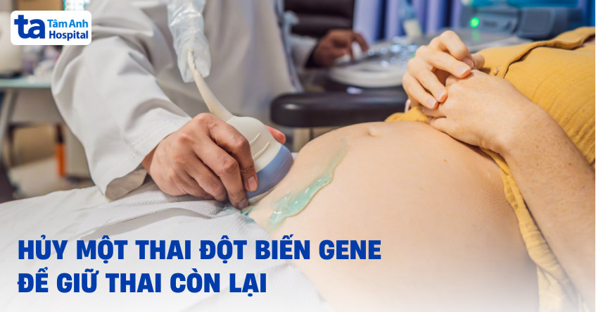 Hủy một thai đột biến gene để giữ thai còn lại