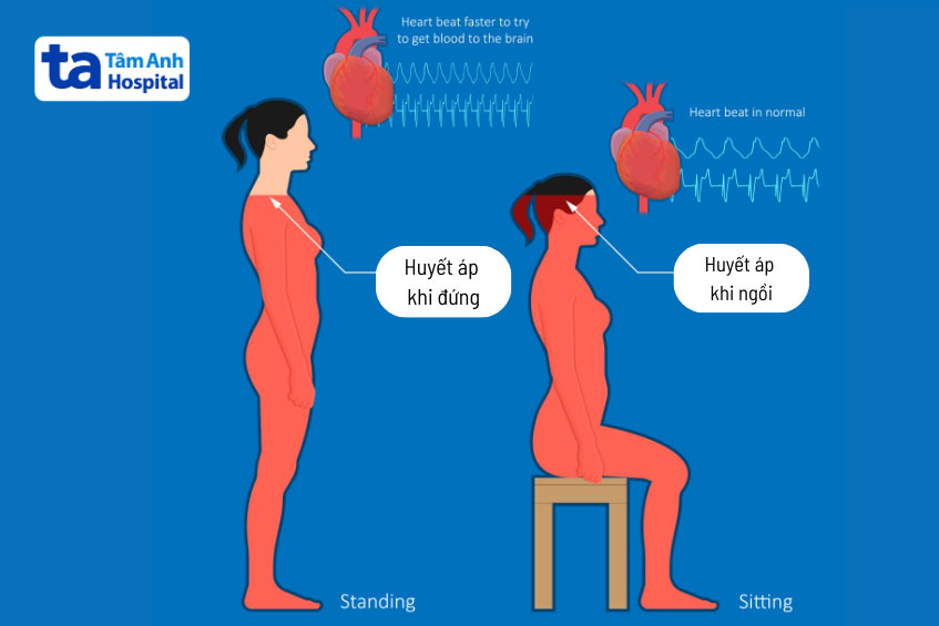 huyết áp khi đứng và khi ngồi